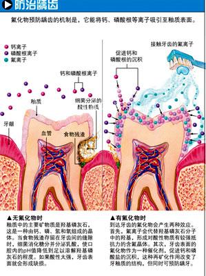 含氟的牙膏好与否？ 